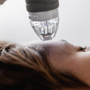 MICROBLADIING as from